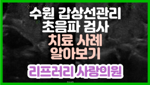 column thumbnail image